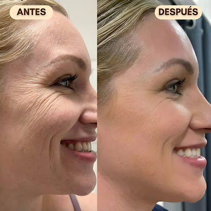 LumiLift™ – Crema Efecto lifting inmediato ¡Alisa las arrugas en solo 2 minutos!