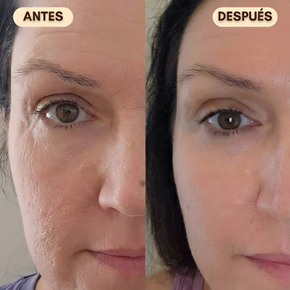 Pack Lifting Profesional LumiLift™ – Piel Firme y Perfecta al Instante