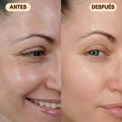 Pack Lifting Profesional LumiLift™ – Piel Firme y Perfecta al Instante